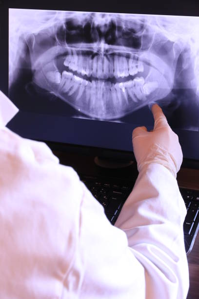 Best Emergency Tooth Extraction in Falling Water, TN