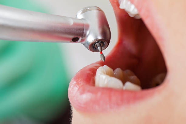 Best Emergency Denture Repair in Falling Water, TN